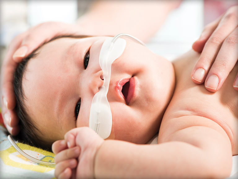 背景图片为一名婴儿正在使用 F&P 950 和Optiflow Junior 鼻塞导管